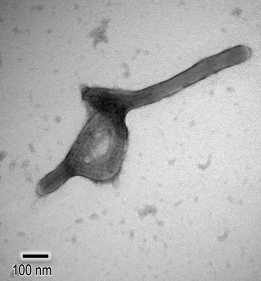 ebolavirus