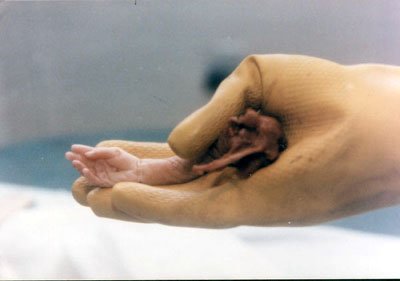 Aborted Baby With Clearly Human Arm and Hand!