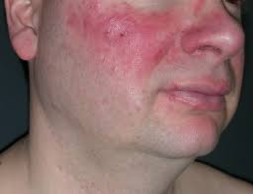 progesterone cream